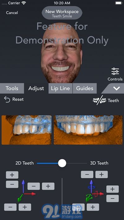 Bellus3D Dental Pro4
