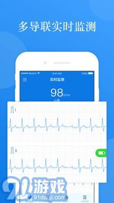 AI ECG1
