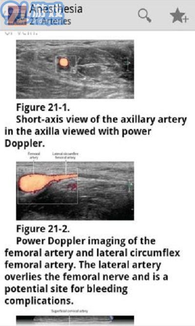 Atlas of Ultrasound超聲引導(dǎo)下區(qū)域麻醉圖集3