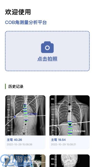 cobb角測(cè)量分析平臺(tái)2