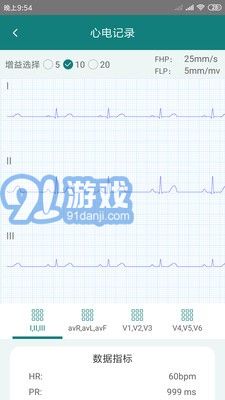 及時(shí)心電2