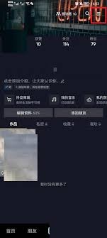 抖音聊天记录如何恢复