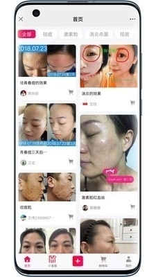 小氫瓶